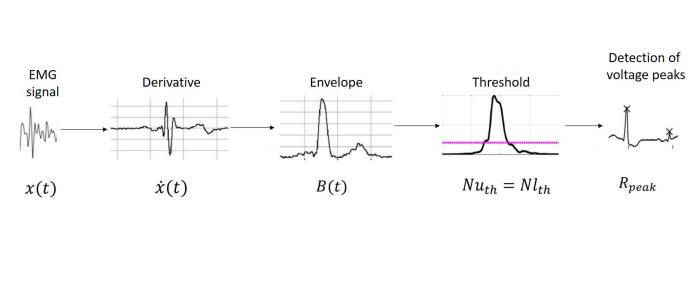 EMGBlockDiagram